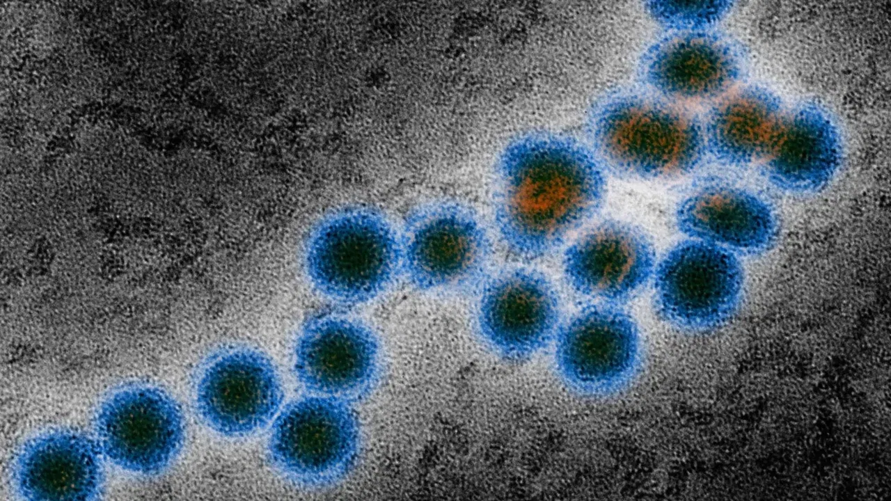 Micrografie colorizată cu particule virale, imagine ilustrativă pentru articolul despre virusul West Nile.